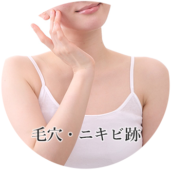毛穴・ニキビ跡