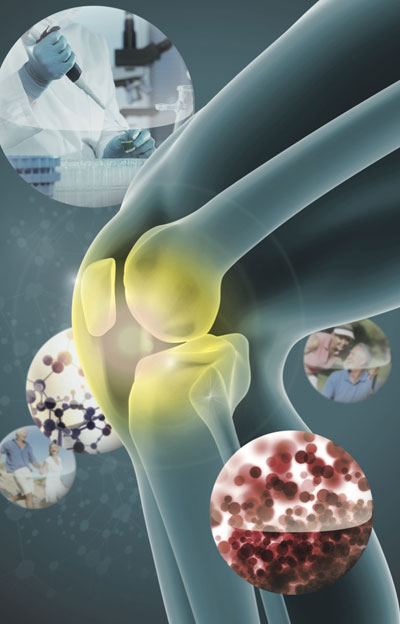 PFC-FD療法の特徴