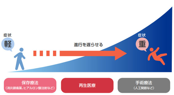 脂肪由来幹細胞(ASC)治療
