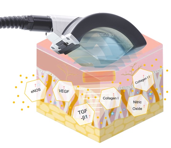 2.「キャビテーション効果」で細胞を活性化
