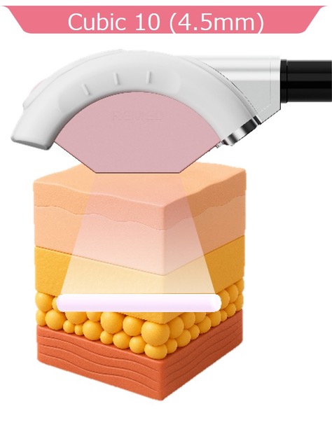 骨美容×REFTONE:深層アプローチ